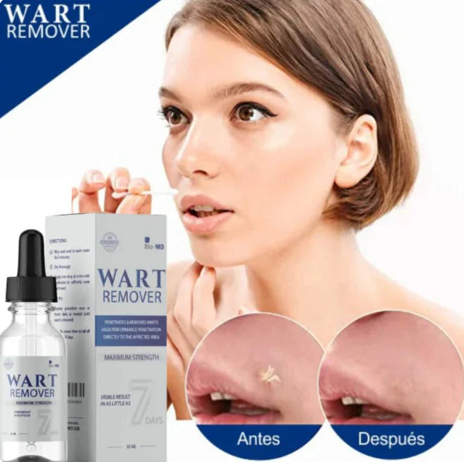 WART REMOVER REMOVEDOR DE VERRUGAS